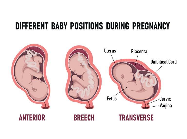 fetus presentation cephalic means